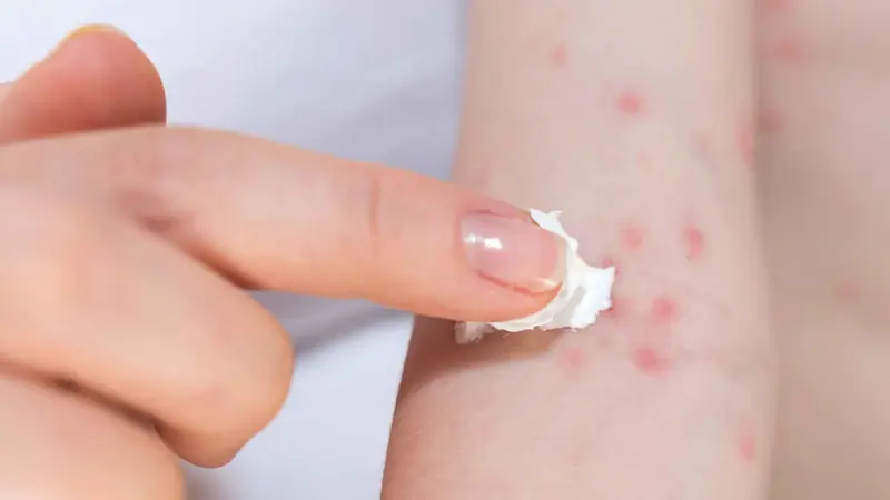 تحيط بك دون أن تراها.. 5 مسببات للحساسية تشاركك منزلك