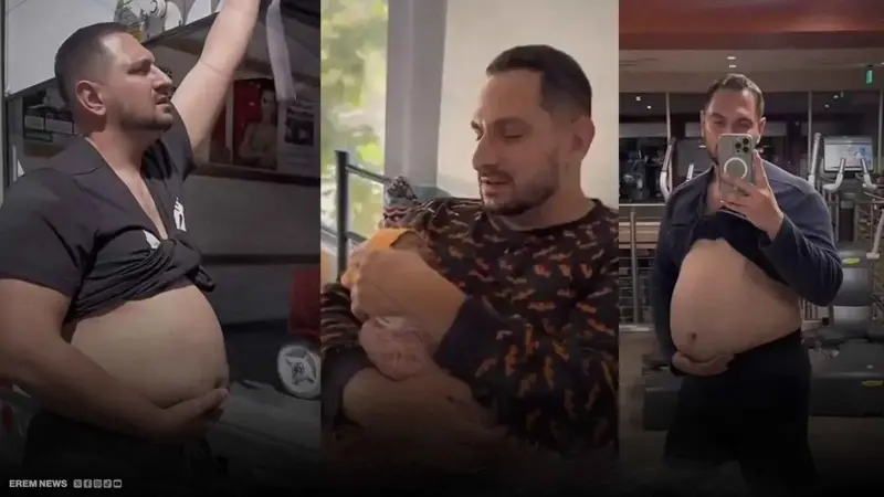 أول رجل عربي "حامل" يخضع لعملية ولادة قيصرية.. ما الحقيقة؟