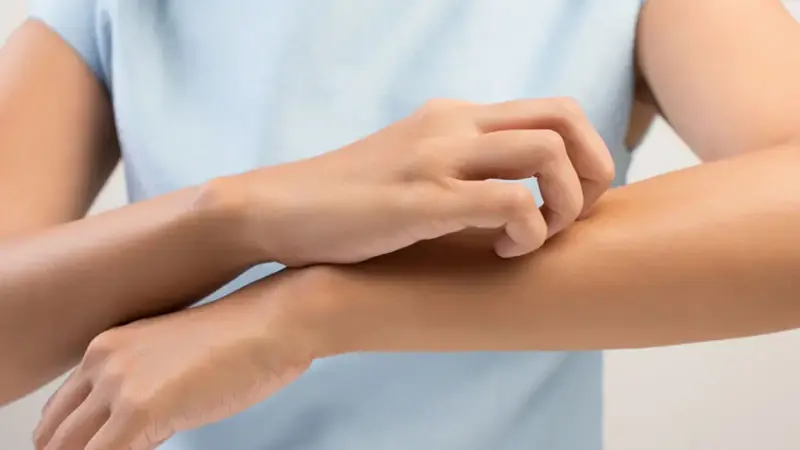 السعودية.. توجيهات جديدة بخصوص مرض الجرب